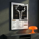 Cuadro Azealia Banks - Broke with Expensive Taste - Catarsis Visual